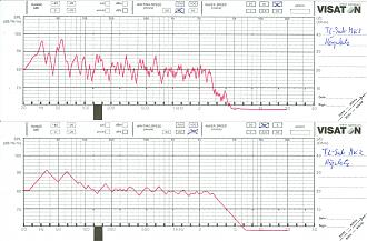 Klicke auf die Grafik für eine vergrößerte Ansicht

Name: Messung TL-Sub MK2 im Hörraum 150922.jpg
Ansichten: 745
Größe: 538,5 KB
ID: 707365
