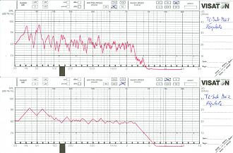 Klicke auf die Grafik für eine vergrößerte Ansicht

Name: Messung TL-Sub MK2 im Hörraum 150922.jpg
Ansichten: 702
Größe: 538,5 KB
ID: 707365